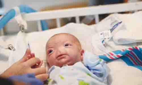 ADORABLE BABY BORN WITHOUT A NOSE